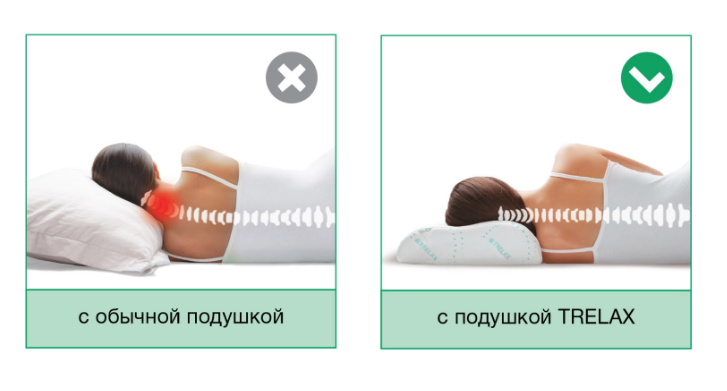 Подушка для путешествий Respecta Compact П07 Трелакс ортопедическая купить в OrtoMir24